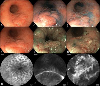 Innovative Diagnostic Endoscopy in Inflammatory Bowel Diseases: From High-Definition to Molecular Endoscopy